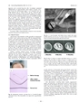 厚生労働科学研究費補助金（難治性疾患克服研究事業） 「Menkes 病・occipital horn 症候群の実態調査、早期診断基準確立、治療法開発に関する研究」 平成23年度 総括・分担研究報告書