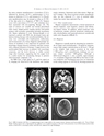 厚生労働科学研究費補助金（難治性疾患克服研究事業）「Menkes 病・occipital horn 症候群の実態調査、早期診断基準確立、治療法開発に関する研究」平成23-24年度 総合研究報告書