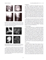 厚生労働科学研究費補助金（難治性疾患克服研究事業）「Menkes 病・occipital horn 症候群の実態調査、早期診断基準確立、治療法開発に関する研究」平成23-24年度 総合研究報告書