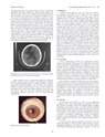 厚生労働科学研究費補助金（難治性疾患克服研究事業）「Menkes 病・occipital horn 症候群の実態調査、早期診断基準確立、治療法開発に関する研究」平成23-24年度 総合研究報告書