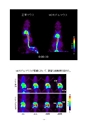 厚生労働科学研究費補助金（難治性疾患克服研究事業）「Menkes 病・occipital horn 症候群の実態調査、早期診断基準確立、治療法開発に関する研究」平成24年度 総括・分担研究報告書