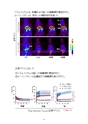 厚生労働科学研究費補助金（難治性疾患克服研究事業）「Menkes 病・occipital horn 症候群の実態調査、早期診断基準確立、治療法開発に関する研究」平成24年度 総括・分担研究報告書