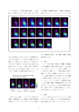 厚生労働科学研究費補助金（難治性疾患克服研究事業）「Menkes 病・occipital horn 症候群の実態調査、早期診断基準確立、治療法開発に関する研究」平成24年度 総括・分担研究報告書